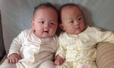 Sinh đôi nhưng diện mạo khác nhau, một bé da đen một bé da trắng, chồng lén vợ xét nghiệm ADN, kết quả khó tin