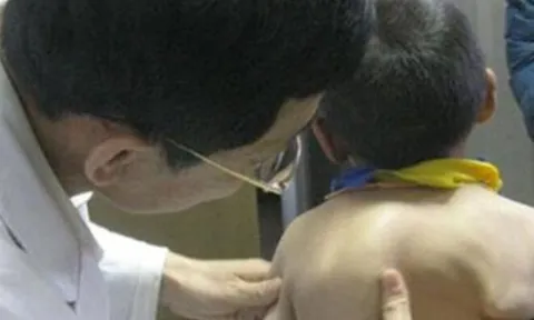 Mẹ phát hiện lưng con ngày càng biến dạng, biết nguyên nhân do thói quen của bà nội, người mẹ hối hận