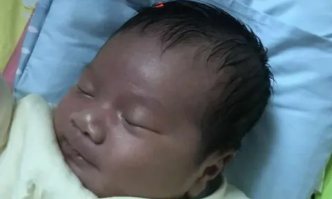 Con sơ sinh chào đời làn da lúc đen xì lúc tím tái, bố mẹ sợ hãi không dám bế và cái kết sau 1 tháng