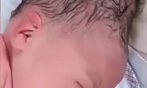 Bé sơ sinh chào đời có hình dáng đầu kỳ lạ, gia đình vừa nhìn thấy đứa trẻ đã sợ không dám bế