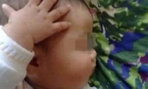 Con trai 1 tuổi liên tục gãi đầu, bố mẹ tưởng hành động bình thường cho đến khi phát hiện sự thật kinh hoàng