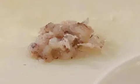 Trường tiểu học nấu món trứng xào tôm cho học sinh, sau khi ăn xong bọn trẻ gọi về nhà cầu cứu bố mẹ