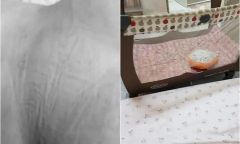 Mẹ âm thầm báo cảnh sát khi thấy vết lạ trên lưng con 14 tháng tuổi, kết quả khám khiến bà rụng rời chân tay