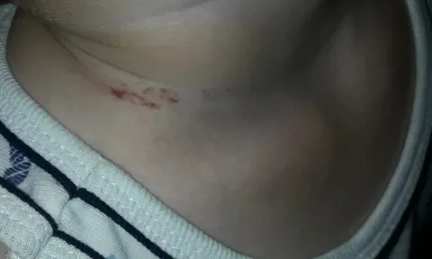 Đón con đi học về thì phát hiện trên cổ bé có vết bầm, kiểm tra camera mẹ Nga bủn rủn với cảnh tượng giữa lớp