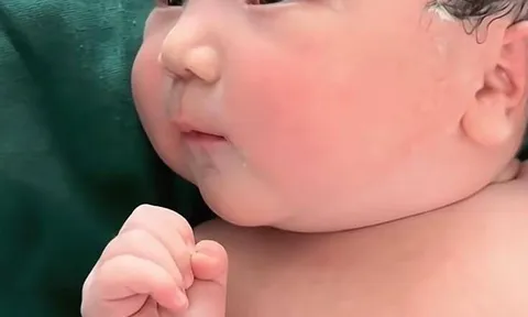 Vừa chào đời bé sơ sinh đã gây náo loạn phòng đẻ vì quá đẹp, bác sĩ phải thốt lên: “Trời ơi, đáng yêu quá”