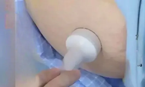 Thai nhi "mất tích" bất thường, bác sĩ lần theo dấu vết và tá hoả khi phát hiện ở vị trí không ai ngờ tới