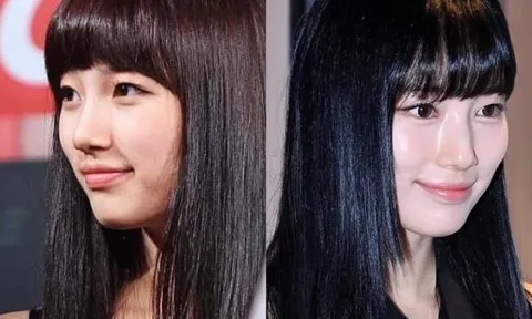 "Tình đầu quốc dân" nhan sắc 10 năm không đổi: Nói "không" với khăn mặt, có phương pháp "vàng" 4-2-4