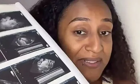 Đẻ xong thấy cơ thể có dấu hiệu lạ, cô gái 19 tuổi khiến ê-kíp bác sĩ sững người khi xem kết quả siêu âm