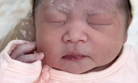 Con sinh 3 ngày vẫn không chịu mở mắt, nhận kết quả khám của bác sĩ bố mẹ mới biết do di truyền