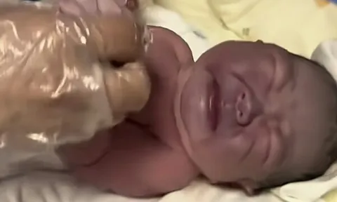 Bà bầu muốn con trắng trẻo nên ngày nào cũng ăn một thứ, phát hoảng khi đứa trẻ chào đời da tím sẫm, nặng 4kg