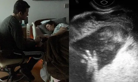 Siêu âm phát hiện con dị tật, nghe lời bác sĩ chọn phá thai, bế em bé trên tay bố mẹ sững sờ
