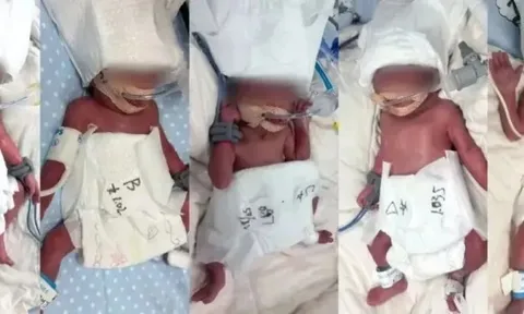 Vợ 24 tuổi mang thai tự nhiên, sinh một lần 5 em bé, câu nói của chồng gây xúc động