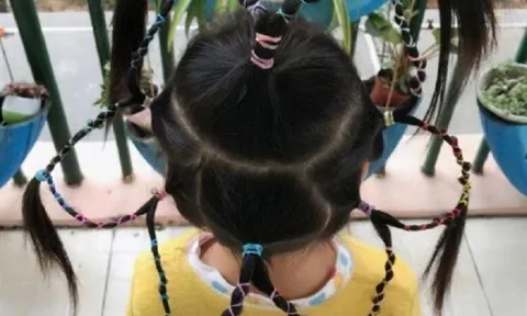 Con gái đi học về mỗi ngày một kiểu tóc nhưng liên tục nói đau đầu, mẹ nhắn tin cho cô giáo thì sốc trước câu trả lời