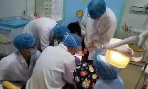 Tưởng keo 502 là son, bé gái bôi lên môi liền bị dính chặt, mẹ tưới thêm 1 thứ được BS khen: Thông minh quá!