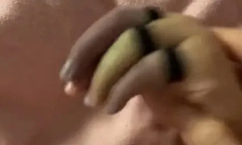 Con ngồi chơi ở phòng khách bỗng khóc rống lên, mẹ phát hoảng thấy tay con 3 màu, bác sĩ cảnh báo