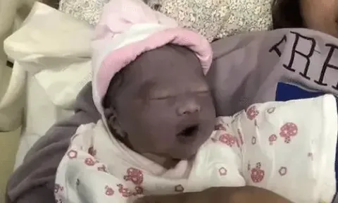 Con vừa chào đời đã có làn da tím khác thường, bố mẹ lo lắng, nào ngờ 2 tháng sau nhận không ra con