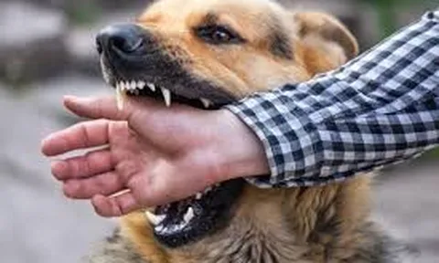 Diễn biến sức khỏe của 3 người ở Mũi Né bị chó dại tấn công