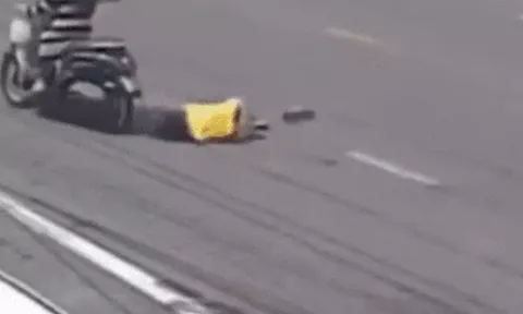 Một người phụ nữ Thái Lan mất bàn tay chỉ vì chiếc áo mà đa số phụ nữ Việt Nam dùng hằng ngày