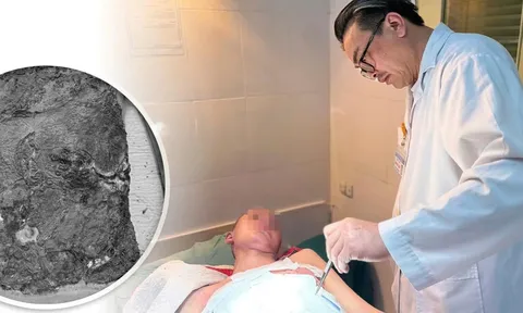 Bé trai 14 tuổi bị hoại tử nặng vì một thói quen nhiều người vẫn hay làm