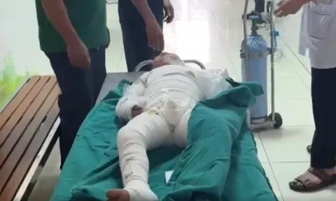 Thương tâm: Người mẹ hoảng hốt nhìn thấy con như ngọn đuốc sống sau tiếng khóc thất thanh