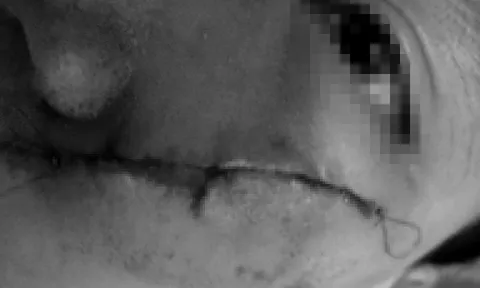 Cháu bé co giật bất thường sau khi bị đánh bằng xẻng tại mái ấm: Bí ẩn sau chiếc camera