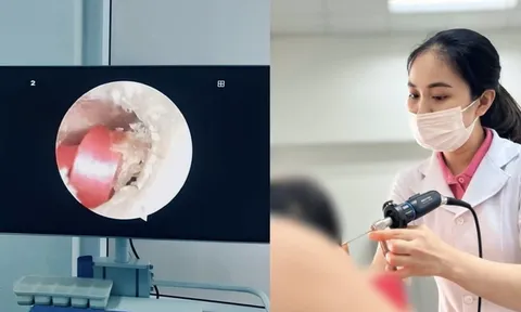 Bé gái 6 tuổi suýt thủng màng nhĩ vì một sợi dây vô cùng quen thuộc, là con gái ai cũng dùng đến ít nhất 1 lần