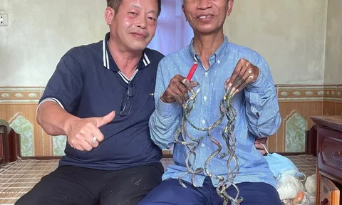 Thông tin bất ngờ của chủ nhân bộ móng tay dài hơn 1m ở Nam Định về việc rao bán giá 7 tỷ đồng