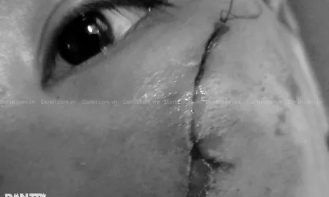 Bé gái co giật bất thường, bị đánh tại mái ấm Thiên Thần sức khỏe hiện ra sao?