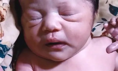 Con sơ sinh chào đời 7 ngày vẫn chưa mở mắt, tưởng con gặp vấn đề mẹ liền đưa đến bệnh viện, kết quả không ngờ