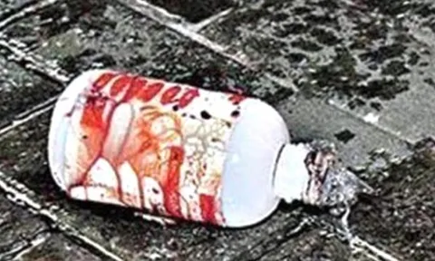 Nữ sinh viên bị bạn trai tạt axit vì từ chối lời cầu hôn ngày 14/2