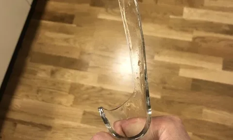 Mâu thuẫn vì mở nhạc lớn, chồng cầm chai thủy tinh dọa đánh, vợ phản kháng đập lại khiến chồng nhập viện