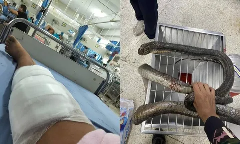 Bị rắn hổ mang dài 3 mét cắn, người phụ nữ tay không hạ gục con rắn mang xác đến viện cấp cứu