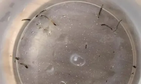 Bé gái 8 tuổi 'nôn ra giun sống' suốt cả tháng: Bác sĩ tiết lộ thủ phạm nhiều nhà đều có