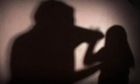 Bé gái 5 tuổi bị bố ruột bạo hành bằng thuốc lá vì không chịu đi ngủ