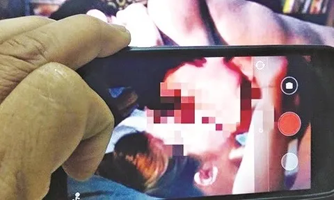 Nam game thủ trơ trẽn tung clip riêng tư với fan nữ lên MXH: Nạn nhân sốc nặng cầu xin xóa clip nhưng bị đối xử tồi tệ