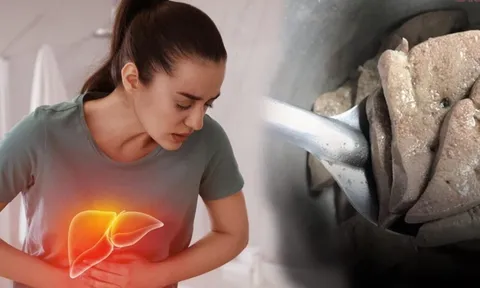 1 bộ phận đại bổ của con lợn nhiều người thích mê: Nếu ăn sai cách dễ đột quỵ, âm thầm rút ngắn tuổi thọ