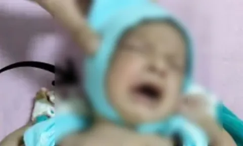 Xót xa: Bé trai sơ sinh 20 ngày tuổi bị bỏ rơi giữa đống rác, miệng nhét đá, môi dán keo