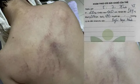 Bé gái 4 tuổi bị cô giáo đánh, kéo lê, ném vào tường: Camera tiết lộ khoảnh khắc kinh hoàng, Phó Hiệu trưởng cũng phải sốc