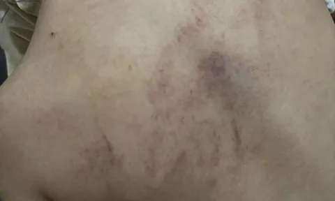 Vụ bé gái 4 tuổi bị đánh, ném vào tường ở Hà Nội: Cô giáo bạo hành nói gì?