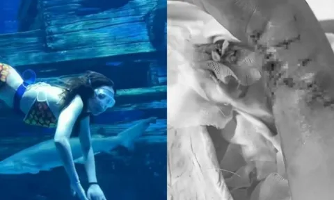 Vụ "nàng tiên cá" co giật dưới đáy bể: Hé lộ sự thật bất ngờ ít người biết