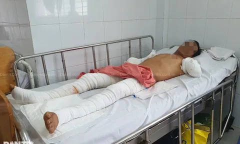 Người đàn ông bị điện phóng phải cắt cụt 2 tay vì làm điều mà nhiều người vẫn hay chủ quan