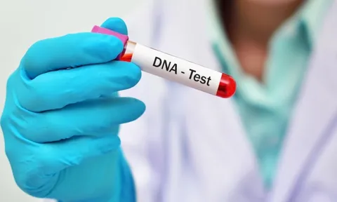 Thấy con dâu có biểu hiện lạ, bố chồng đổi cách xét nghiệm ADN thì lộ ngay sự thật bất ngờ phút cuối