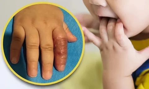 Em bé suýt phải cắt cụt ngón tay vì hành động đơn giản này của người mẹ