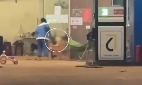 Bé trai 16 tháng tuổi bị bác dâu túm chân nhấc bổng, ném xuống sàn xi măng: Hoàn cảnh vô cùng đáng thương