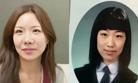 Nữ diễn viên 8 lần cắt mắt, nâng ngực, gọt hàm: Nhan sắc hiện tại cực sốc