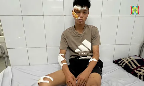 "Quái xế" thông chốt bảo vệ A80, tông cảnh sát cơ động chấn thương sọ não: Nước mắt ngắn dài nói về giây phút tội đồ