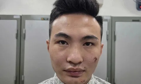 Danh tính kẻ say xỉn thông chốt bảo vệ A80, tông ngã công an phường