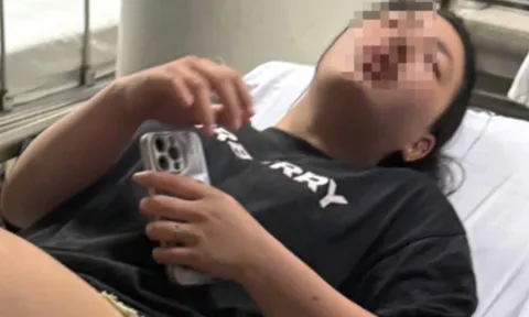 "Sẽ còn tìm đánh lần nữa"- câu nói khiến cô gái 19 tuổi ở Hà Nội sốc và sống trong sợ hãi sau khi bị đánh "thập tử nhất sinh"