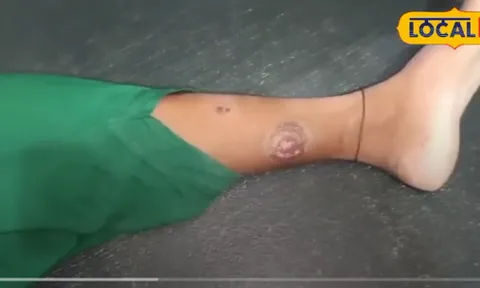 Cô gái trẻ sống sót kỳ diệu sau 41 lần bị rắn cắn, điều gì đã xảy ra?