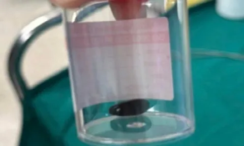 Bé 13 tháng tuổi bị viêm phổi nặng, suy hô hấp vì một điều mà nhiều người có thể chủ quan